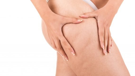 Les leggings anti-cellulite sont-ils vraiment efficaces?